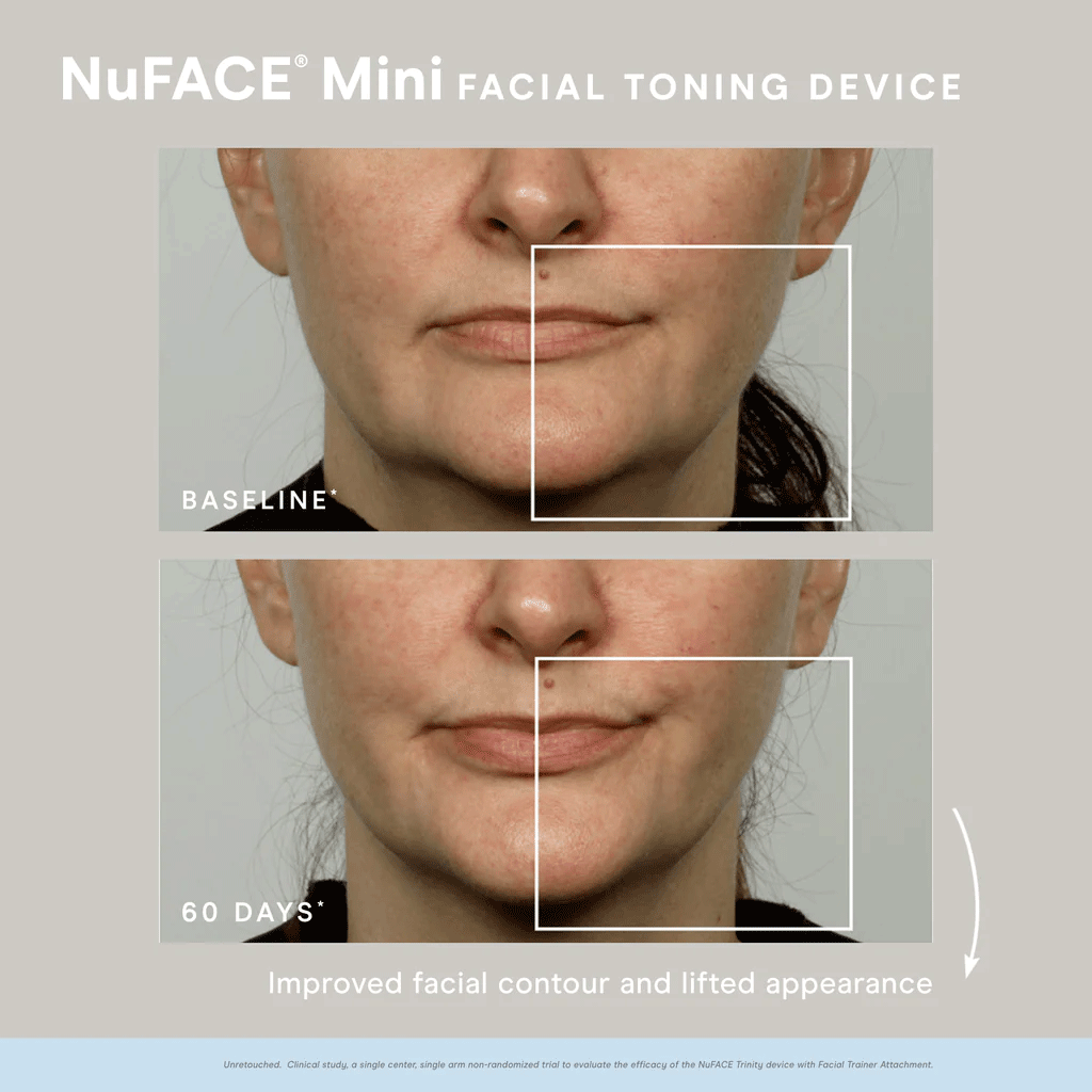 NuFACE - MINI FACIAL TONING DEVICE (includes 1.69 oz Aqua Gel)