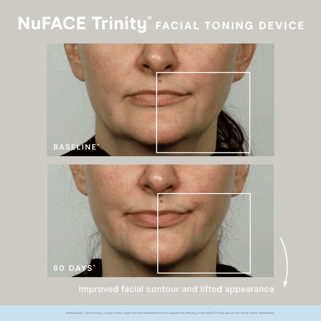 NuFACE - TRINITY FACIAL TONING DEVICE (includes 1.69 oz Aqua Gel)