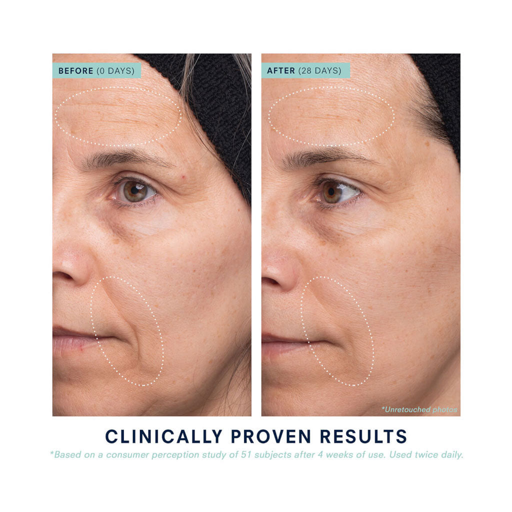 KORA ORGANICS – TURMERIC GLOW MOISTURIZER (15ML)