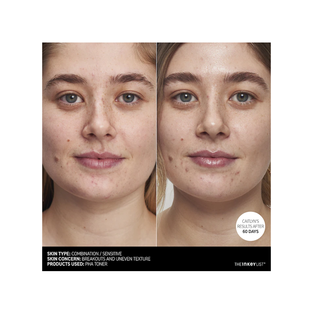 The INKEY List - Polyhydroxy Acid (PHA) Gentle Exfoliating Toner