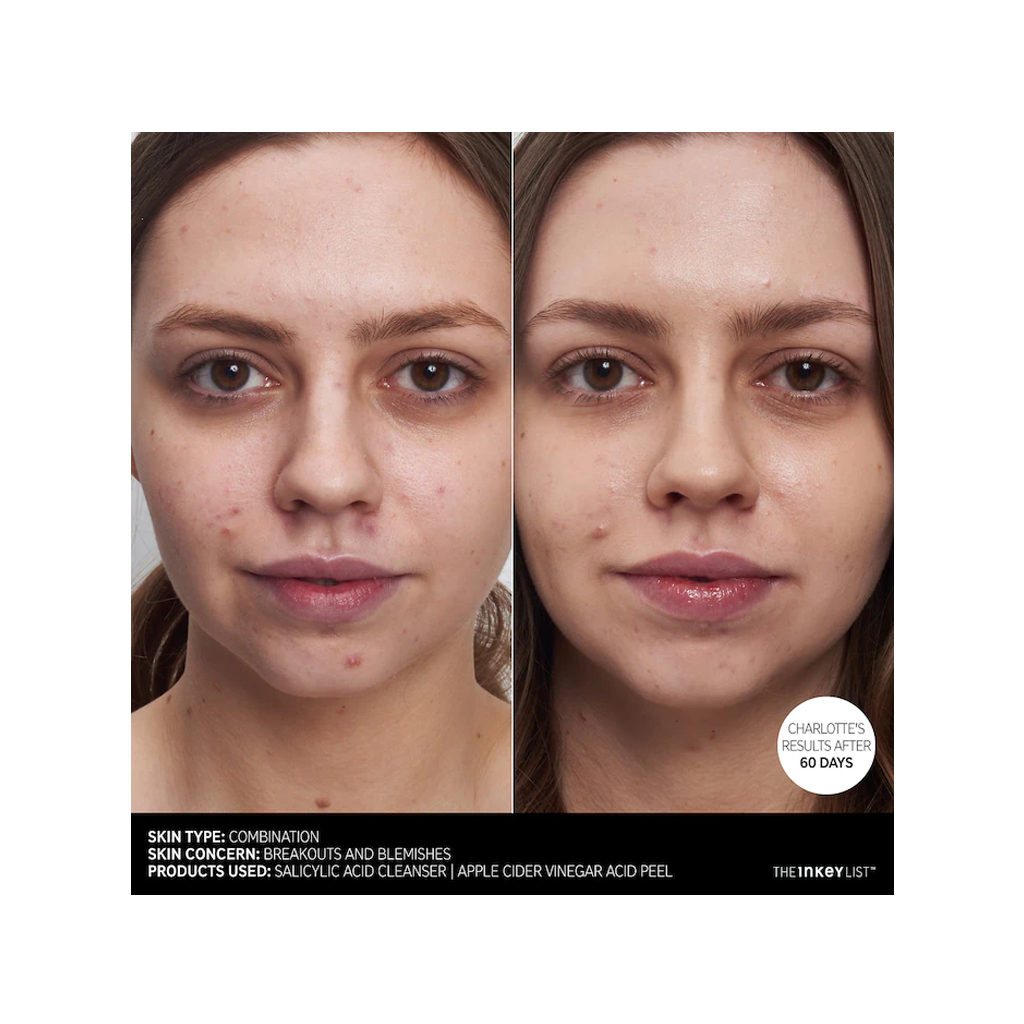 The INKEY List - Salicylic Acid Acne + Pore Cleanser (150ml)